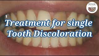 How to whiten a single dark tooth  causes and treatment of single tooth discoloration [upl. by Bryan]