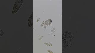 Paramecium and Ciliates 100x  800x Magnification science microscope 12 [upl. by Llener]