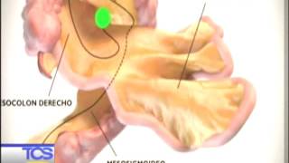 Salud el mesenterio quotel nuevo órganoquot del cuerpo [upl. by Tosch246]