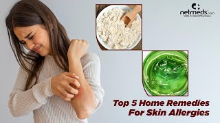 5 Best Natural Remedies For Skin Allergies [upl. by Wolff910]