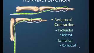 Insight into the Lumbrical Muscle amp Testing for Tightness Preview [upl. by Mandi]