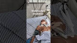 ENDOTRACHEAL INTUBATION  EMERGENCY PROCEDURES [upl. by Aili338]