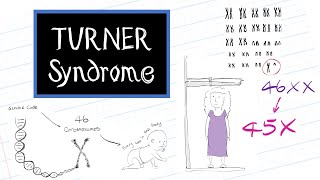 What is Turner Syndrome HealthSketch [upl. by Jenei]