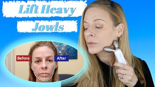 How I Lifted My Heavy Jowls  Medicube  Age R Derma EMS Device  Over 40 [upl. by Nostaw]