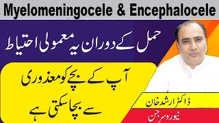 Myelomeningocele And Myelomeningocele CausesSymptoms And Treatment In Urdu [upl. by Nivej]