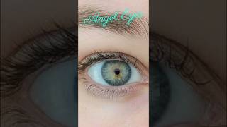 Angle Eyes 👁️ Central Heterochromia [upl. by Stanfield]