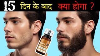 Ustraa Beard Growth Oil After 15 Days Review  Best Beard Oil For Patchy Beard in India 2024 [upl. by Notlrak]