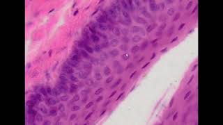 Stratified Squamous Epithelium HampE Staining  PUMS Histology Slides Review Series [upl. by Harrak847]