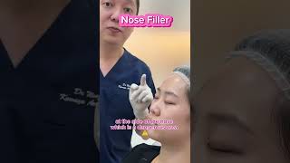 Where and How Fillers are Injected [upl. by Ayerdna121]