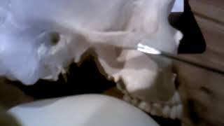 Zygomatic bone Nasal bone Lacrimal bone Inferior nasal conchae [upl. by Sheldon]