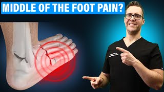 Lisfranc Injury Treatment amp Recovery Time Middle Foot Pain CURE [upl. by Aneri]