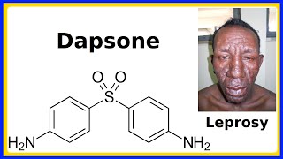 dapsone [upl. by Aiselad806]