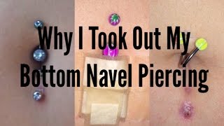 Why I Took Out My Bottom Navel Piercing [upl. by Oriane172]