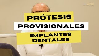 La importancia de los provisionales para los implantes dentales [upl. by Aketal]