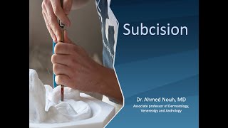 Subcision with English subtitles [upl. by Yerahcaz]