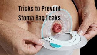 Tricks to Prevent Stoma Bag Leaks [upl. by Longley]