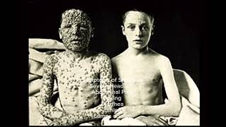 The Smallpox Epidemic of 1870 For school [upl. by Shirl]