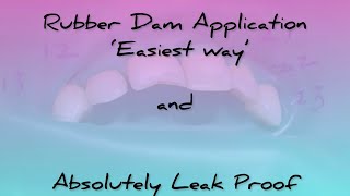 Rubber dam application in exact one and a half minutes [upl. by Tteragram213]