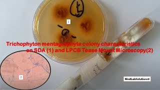 Trichophyton mentagrophyte colony characteristics on SDA and LPCB Microscopy [upl. by Gunn973]