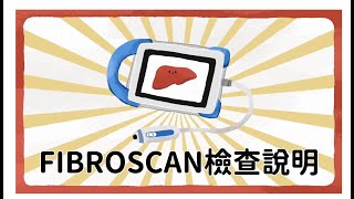 Fibroscan 肝纖維化掃描儀 [upl. by Descombes17]