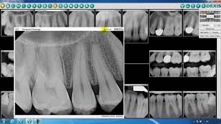 DEXIS™ Imaging Suite Image and Navigator Overview [upl. by Craggie]