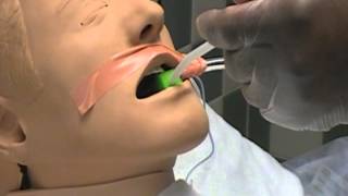 Mouth Care on Intubated Patients [upl. by Beau]