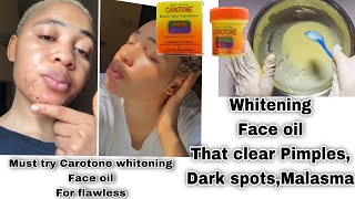 Use Carotone without side effects  How to Mix Carotone to whitening face oil for whiten dark spots [upl. by Ennoitna]