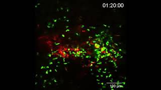 Intravital microscopy macrophages recruited to exosomes [upl. by Joana]