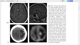 CASE BASED BRAIN IMAGING [upl. by Arrahs288]