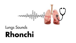 Rhonchi  Lung Sounds  Medzcool [upl. by Ycinuq]