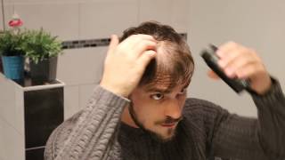 HAIRVISUAL  Astuce pour cacher une calvitie précoce homme femme [upl. by Amabil]