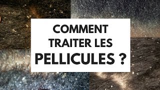 COMMENT TRAITER LES PELLICULES [upl. by Harac953]