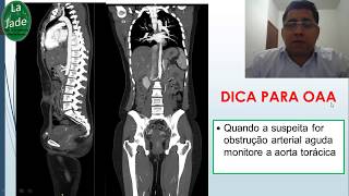 Angiotomografia de aorta COMO FAZER A AQUISIÇÃO [upl. by Spracklen]