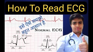 ECG Part2 ECG Interpretation  Be Your Best Doctor [upl. by Estell]