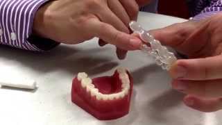 Sharp edges with your Invisalign plates how and what to do Dr Andrew Chang Smiles amp Faces Ortho [upl. by Ednutabab]