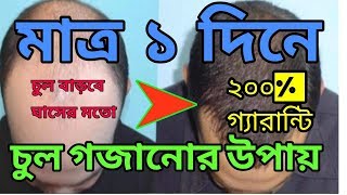 Chul gojanor upay  চুল গজানোর উপায়  ২০০ গ্যারান্টি [upl. by Ariik]