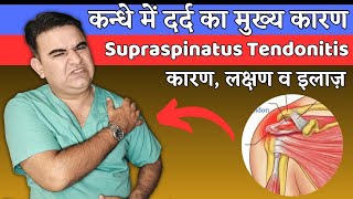 How to RELIEVE SUPRASPINATUS TENDONITIS  SHOULDER PAIN RELIEF EXERCISES [upl. by Naugan96]