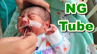 Nasogastric NG Tube Insertion in NeonateNewborn  Orogastric OG TubeFeeding Tube  Paediatric [upl. by Refannej]