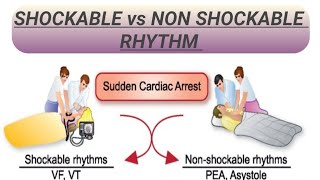 SHOCKABLE vs NON SHOCKABLE RHYTHM [upl. by Onyx629]