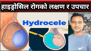 Hydrocele details in Nepali हाइड्रोसिल कसरी हुन्छ यसको लक्षण तथा औषधि उपचार कसरी गर्ने [upl. by Rodger]