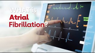 What is Atrial Fibrillation [upl. by Arrimat889]