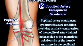 Anatomy Of The Popliteal Fossa  Everything You Need To Know  Dr Nabil Ebraheim [upl. by Mohandas]