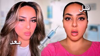 غيرت شكلي بالكامل 💉 تجميل كامل 🤩 بسمةداش [upl. by Ahsela518]