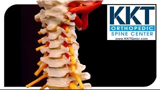 KKT Qatar Non invasive treatment for back pain and spine care [upl. by Noivaz]