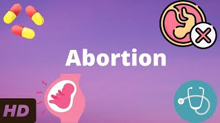 Abortion Everything You Need To Know [upl. by Alahsal]