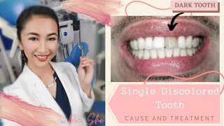 How to treat a discolored or dark tooth  zirconia crown [upl. by Lewiss936]