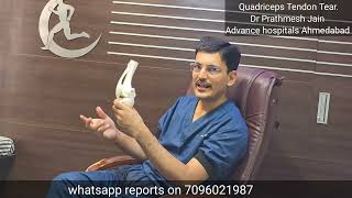 Quadricep Tendon tear Best treatment full detail in hindi [upl. by Adikram]