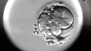 Timelapse of fertilisation of a human egg under the microscope [upl. by Etteroma]