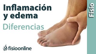 Inflamación y edema  Diferencias y características [upl. by Bethesda107]