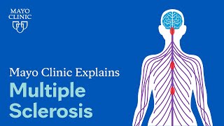 Mayo Clinic Explains Multiple Sclerosis [upl. by Eduam729]